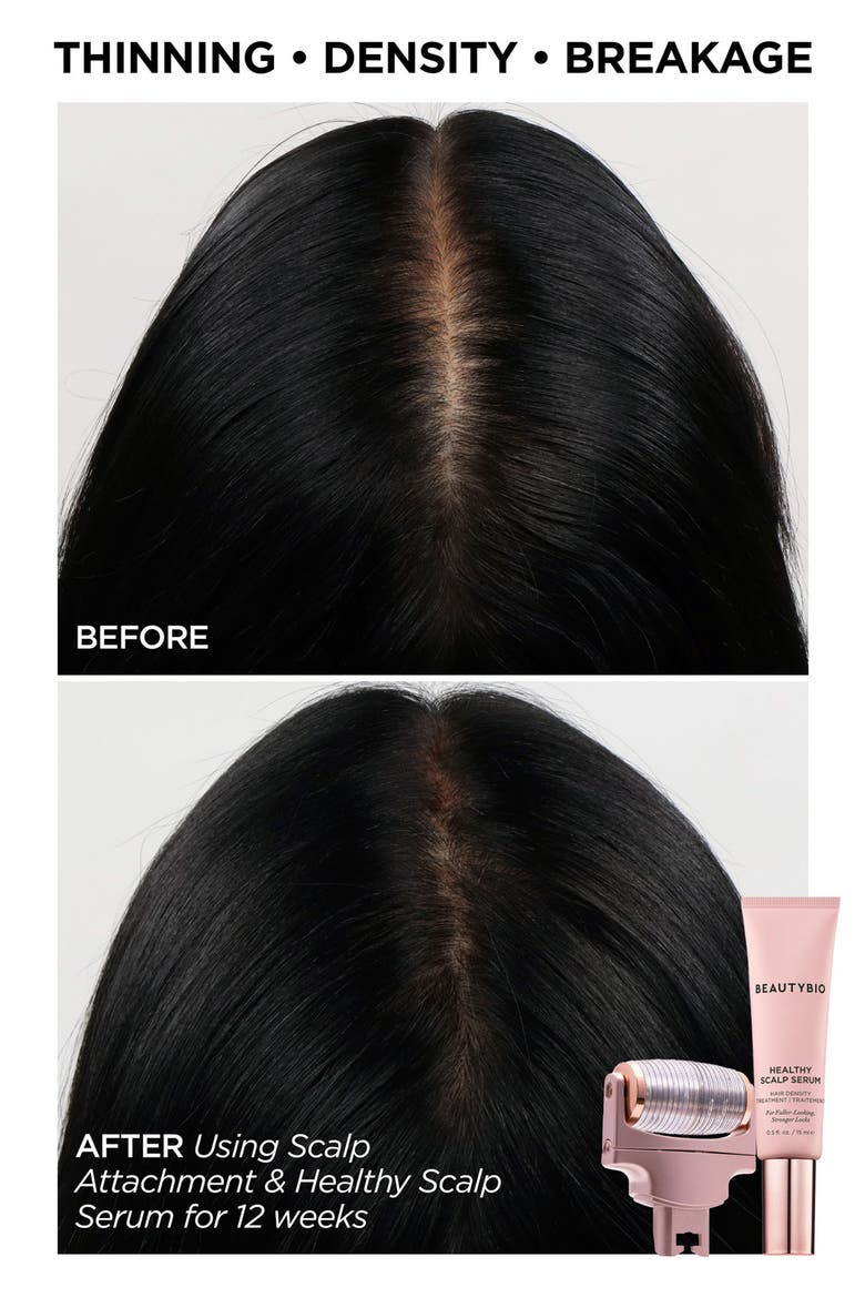 GloPRO® Skin & Hair Goals Set $353 Value, Alternate, color, NO COLOR