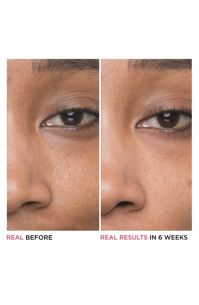 IT Cosmetics Bye Bye Pores Glycolic Acid Serum, Alternate, color,