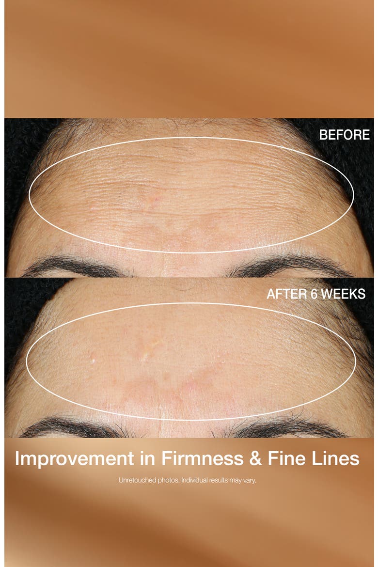 Multi-Action Super-C Retinol Brighten & Correct Vitamin C Serum, Alternate, color, NO COLOR