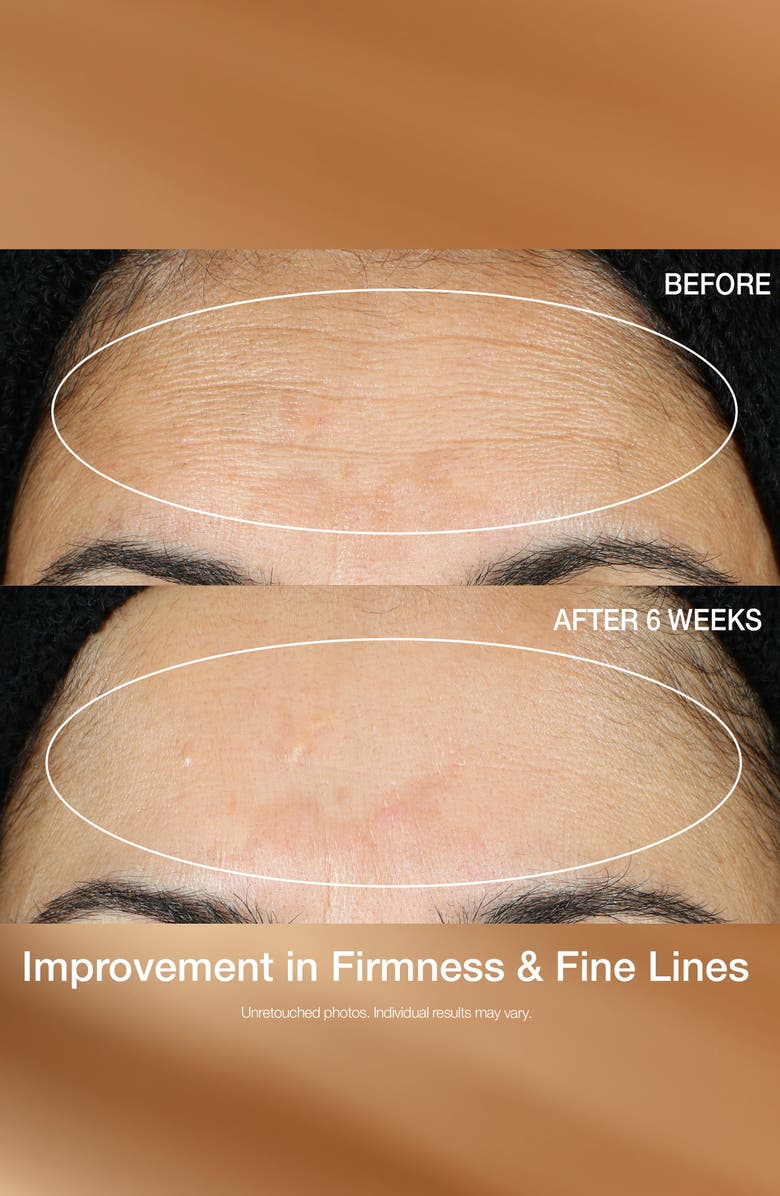 StriVectin<sup>®</sup> Multi-Action Super-C Retinol Brighten & Correct Vitamin C Serum, Alternate, color, 