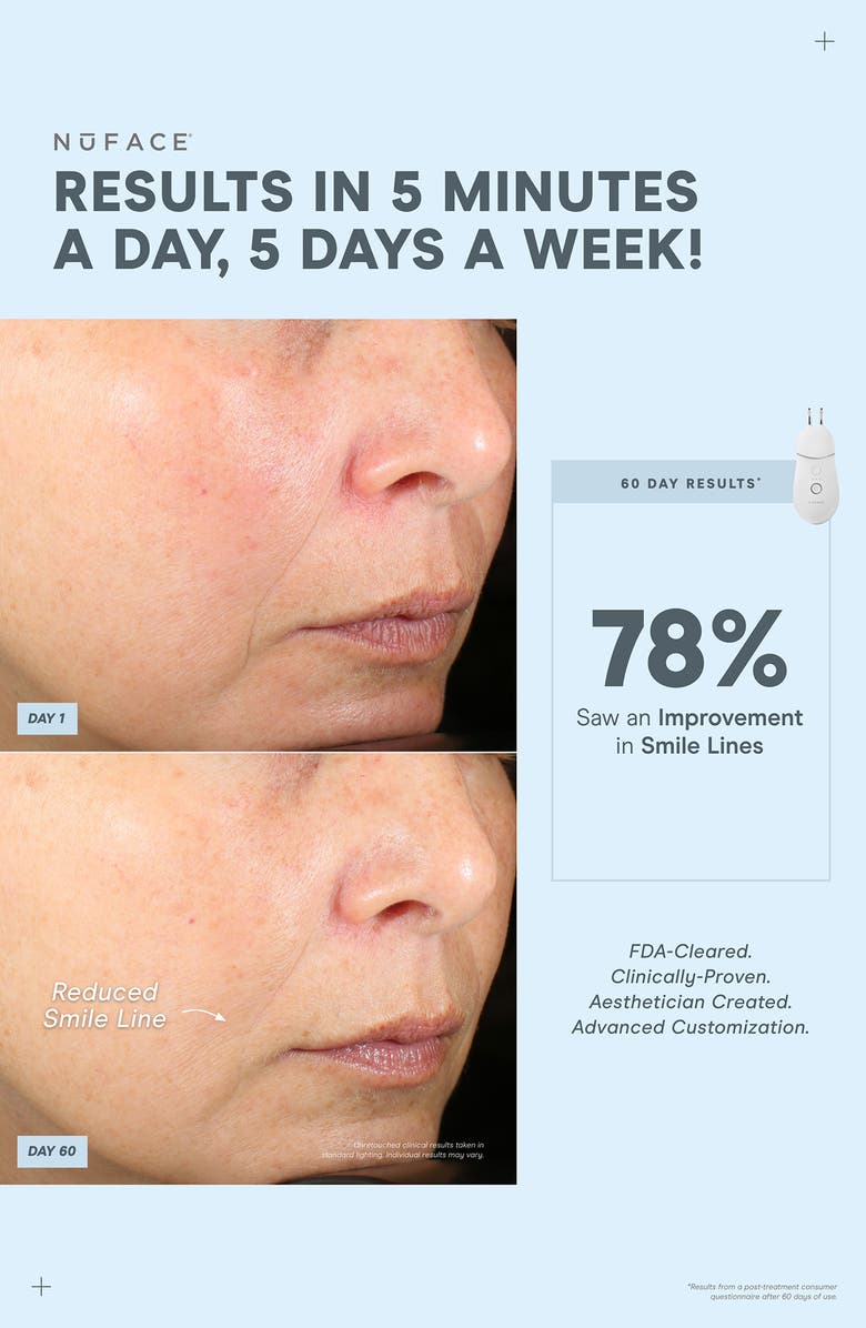 NuFACE<sup>®</sup> TRINITY+ Effective Lip & Eye Attachment, Alternate, color,