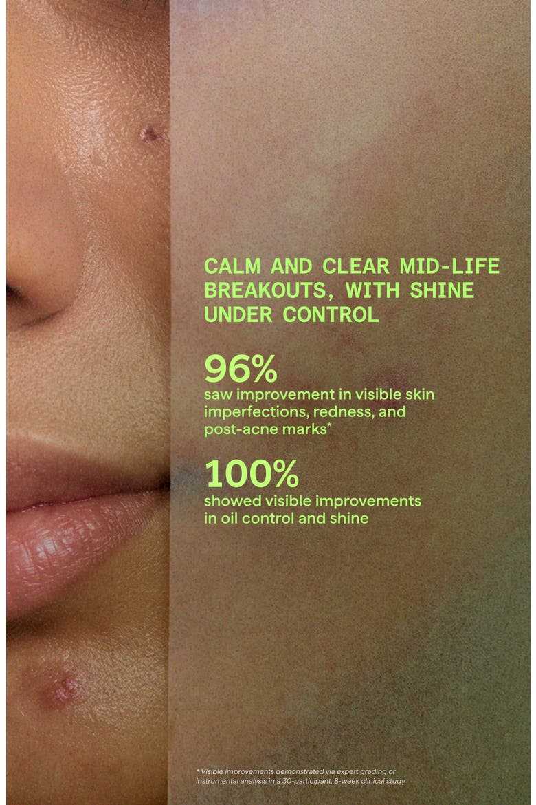 Biome-Balancing Calm & Recover Cream, Alternate, color, NO COLOR