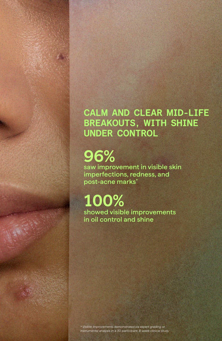 Murad<sup>®</sup> Biome-Balancing Calm & Recover Cream, Alternate, color,