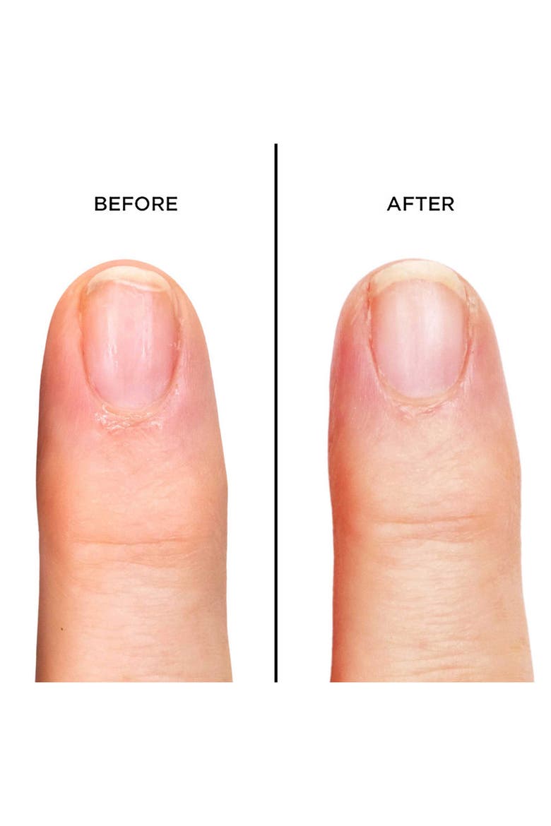 'Horse Power™' Nail Rescue Basecoat, Alternate, color, NO COLOR