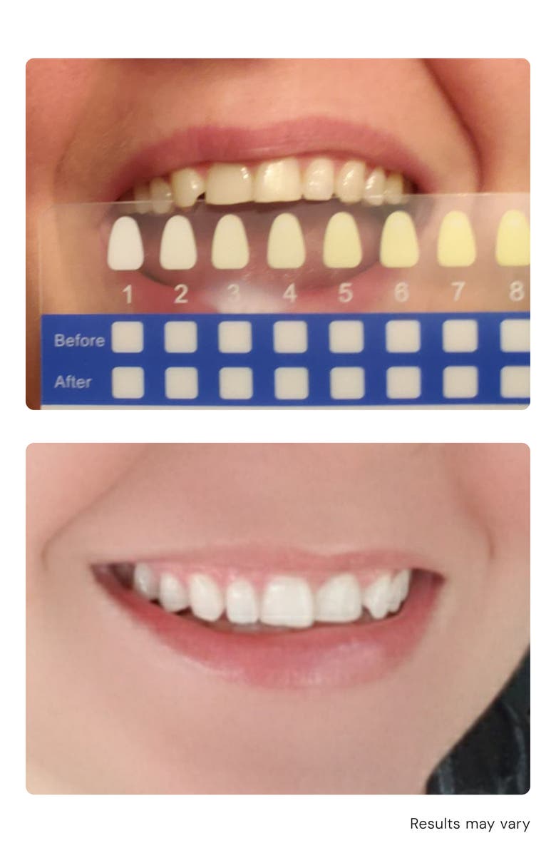 SNOW Daily Whitening Booster Gel, Alternate, color, White