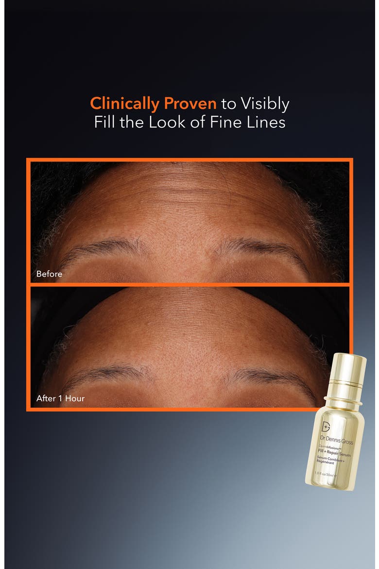DermInfusions Fill + Repair Serum, Alternate, color, NO COLOR
