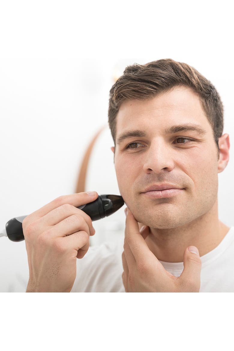 Personal Microderm Pro Man - Black, Alternate, color, BLACK