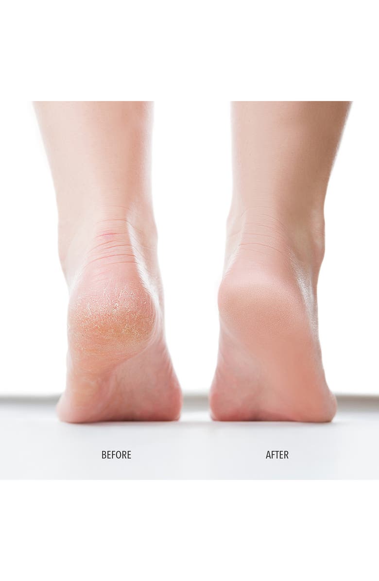 Londontown Foot Scrub, Alternate, color,