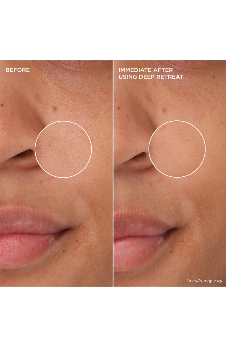 Benefit Cosmetics The POREfessional Picks (Limited Edition) $54 Value, Alternate, color,