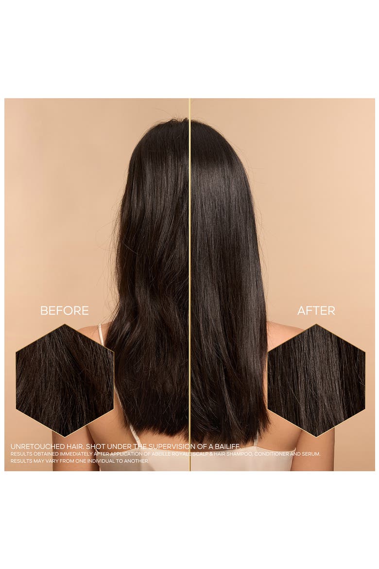 Abeille Royale Scalp & Hair Youth Ritual Set (Limited Edition) $170 Value, Alternate, color, NO COLOR
