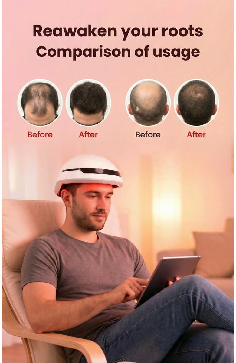 Lovery Laser Red Light Therapy Device for Hair Growth - 650nm Professional System, Alternate, color, White