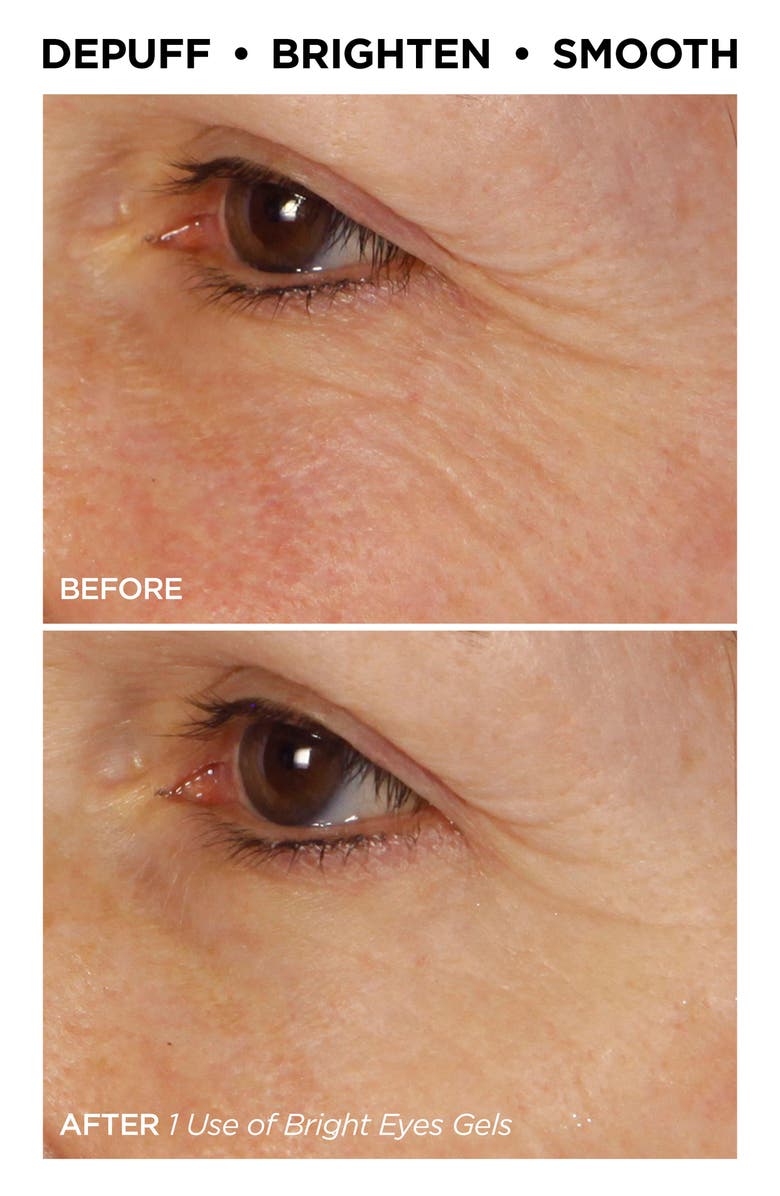 BeautyBio Lights Out Mask On Set, Alternate, color,