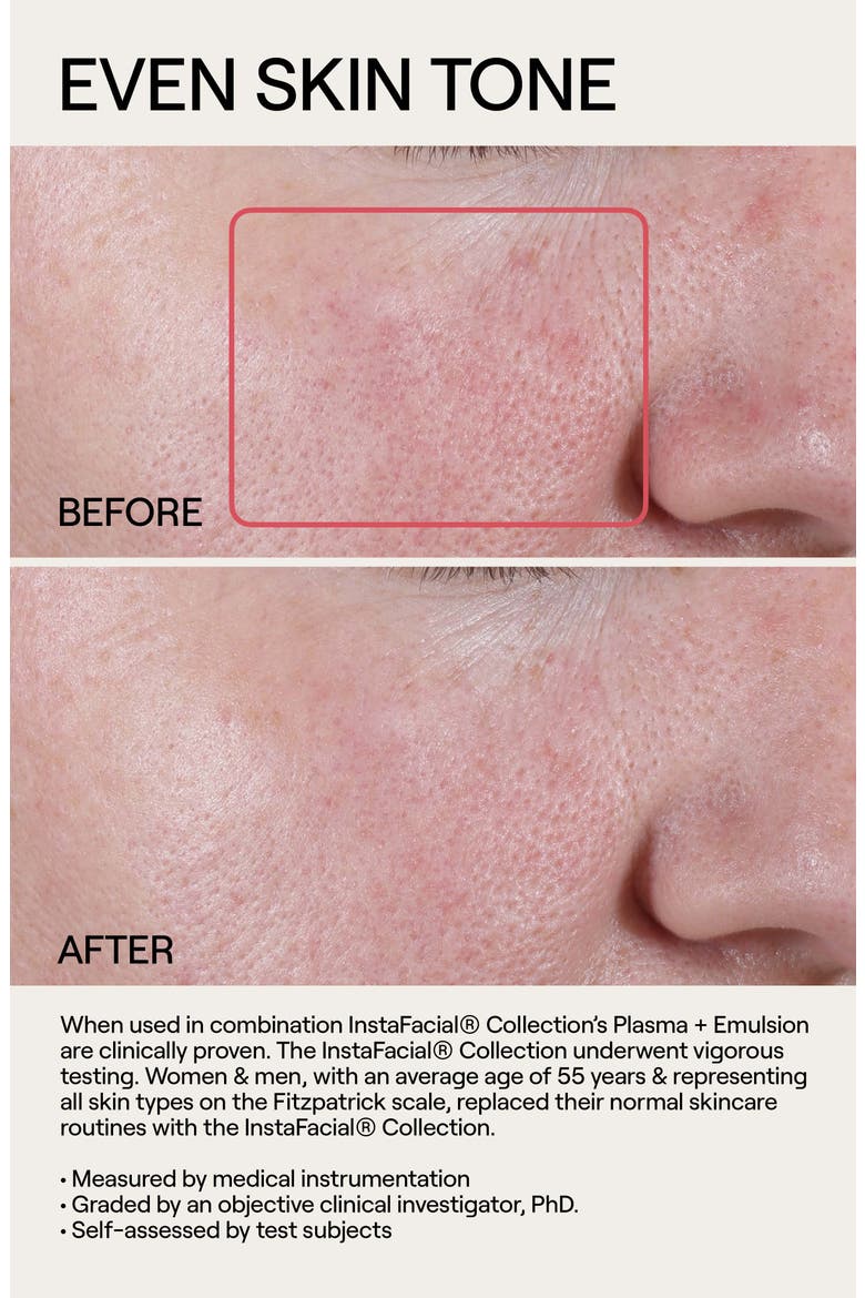 Instafacial® Plasma Serum Duo $400 Value, Alternate, color, NO COLOR