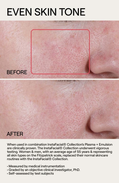 Dr. Diamond’s Metacine Dr. Diamond's Metacine Instafacial® Plasma Serum Duo $400 Value