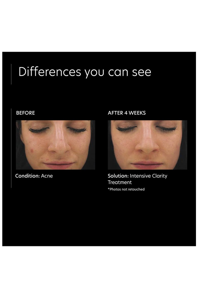 0.5% Pure Retinol Night Intensive Clarity Treatment®, Alternate, color, NO COLOR