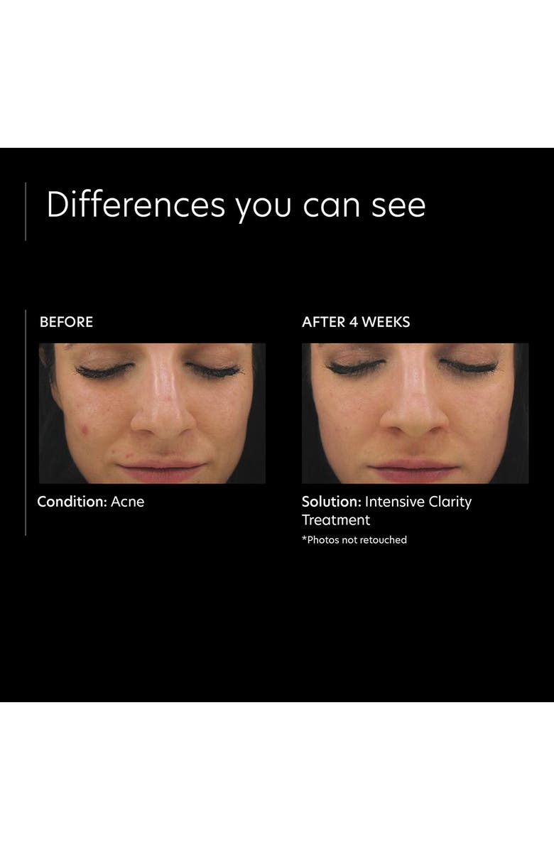 PCA Skin 0.5% Pure Retinol Night Intensive Clarity Treatment<sup>®</sup>, Alternate, color,