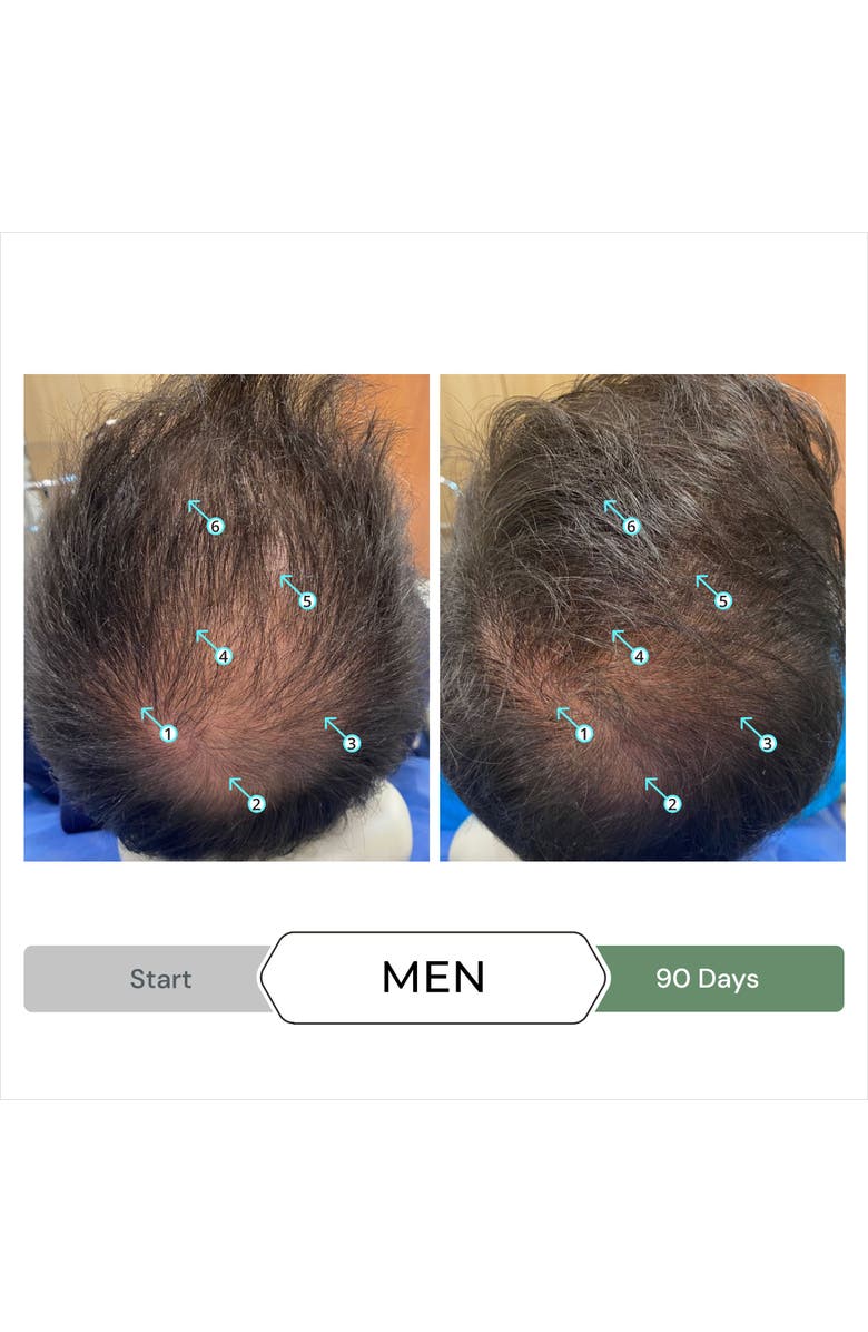 DS Laboratories Revita.CBD Super Antioxidant Hair Density CBD Conditioner, Alternate, color, NO COLOR
