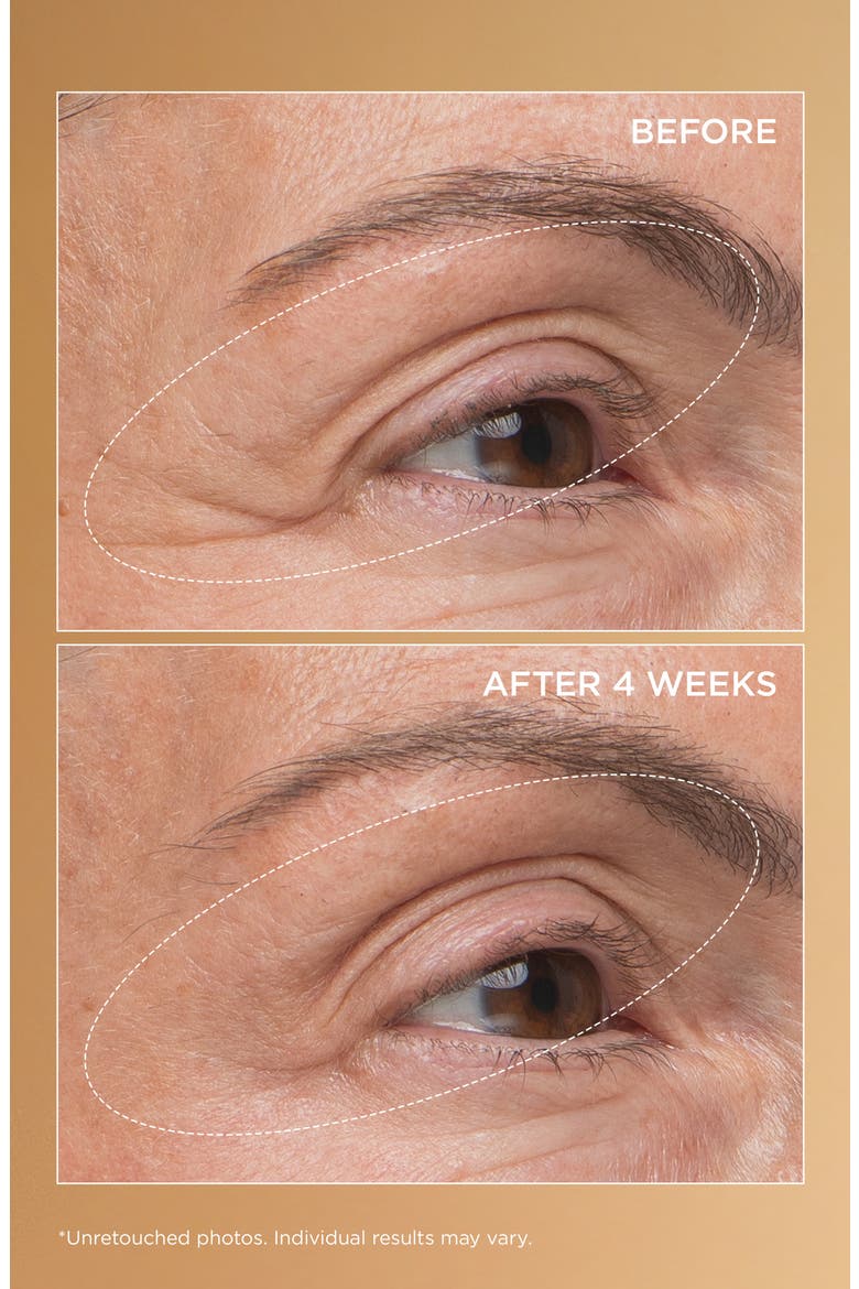 Neuropeptide Eyelid Lift Serum, Alternate, color, NO COLOR