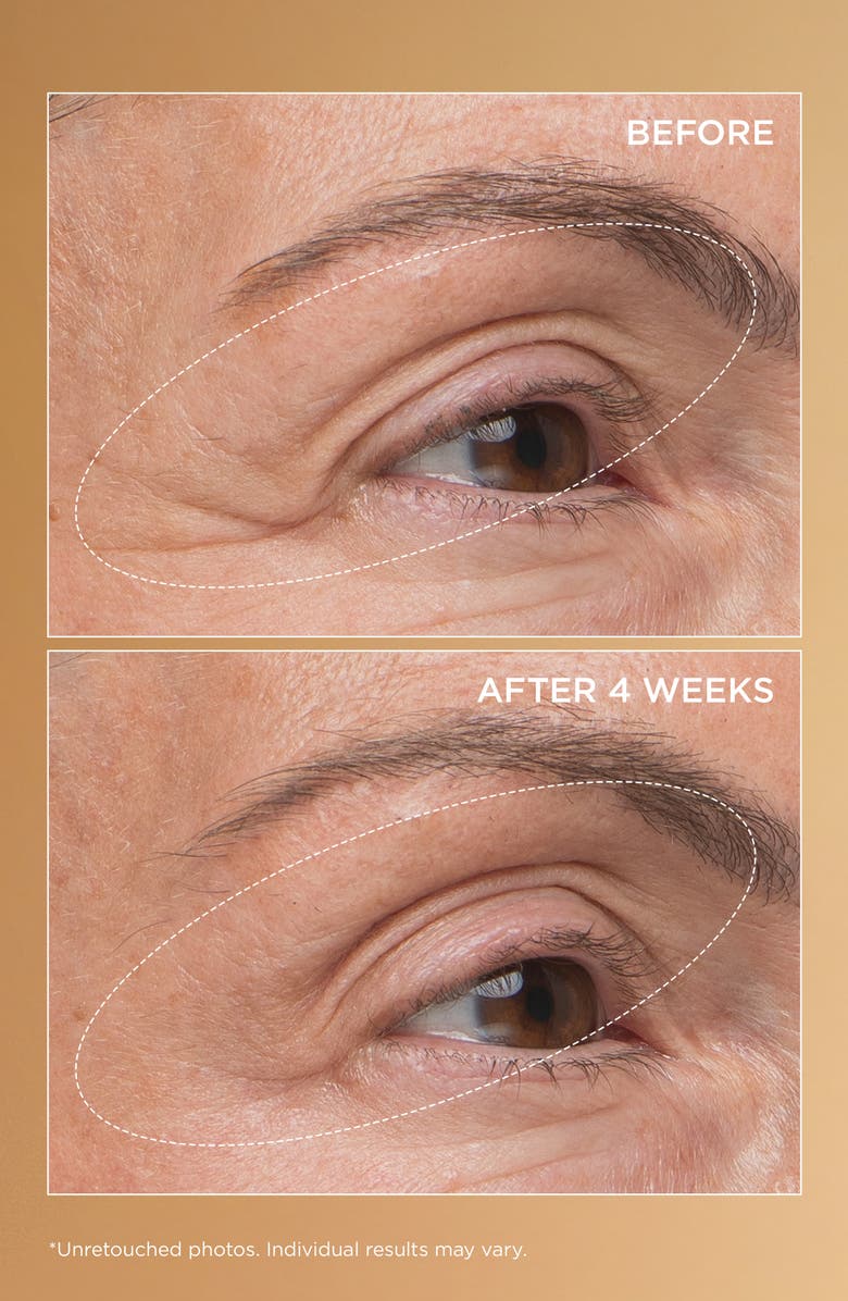 Perricone MD Neuropeptide Eyelid Lift Serum, Alternate, color, 