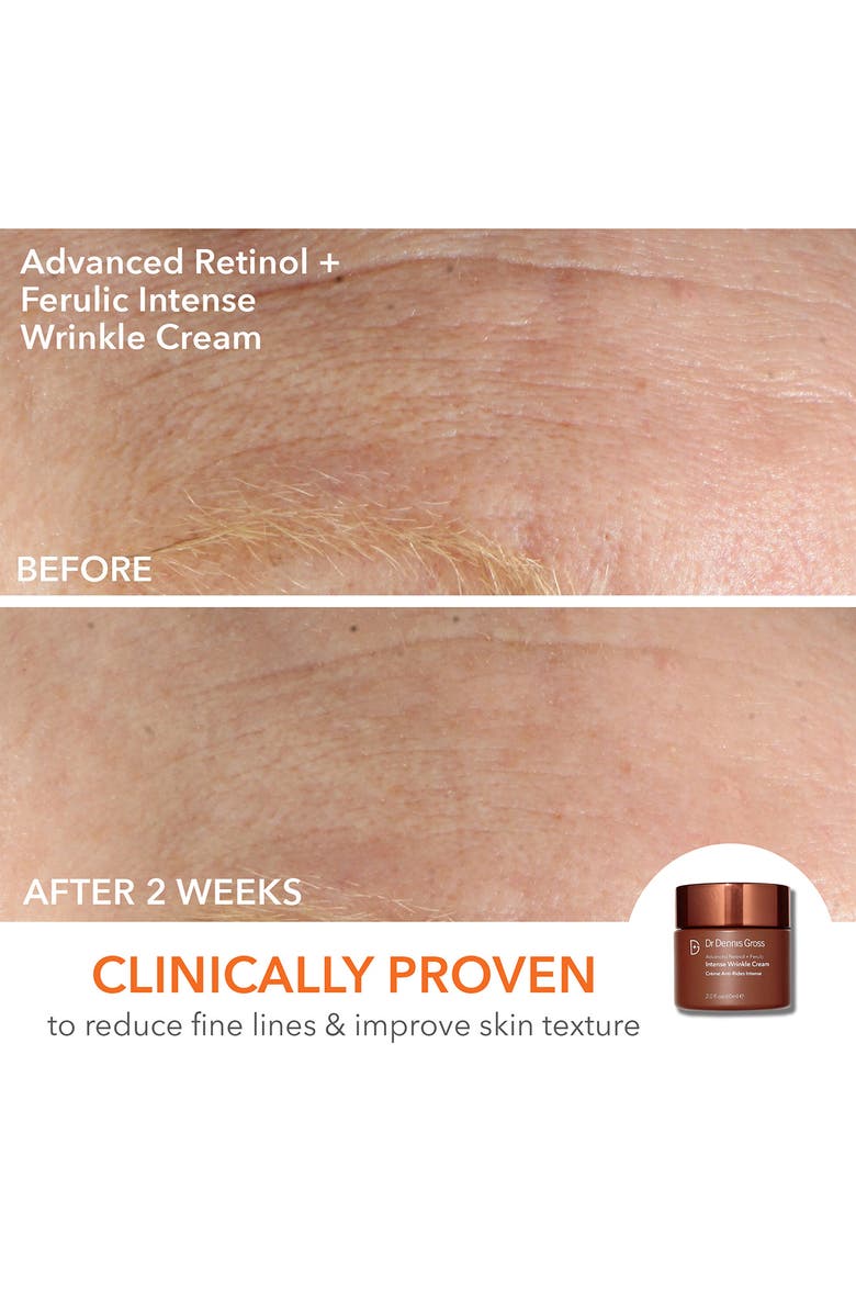 Dr. Dennis Gross Skincare Light It Up Faceware Bundle (Limited Edition) USD $598, Alternate, color, 