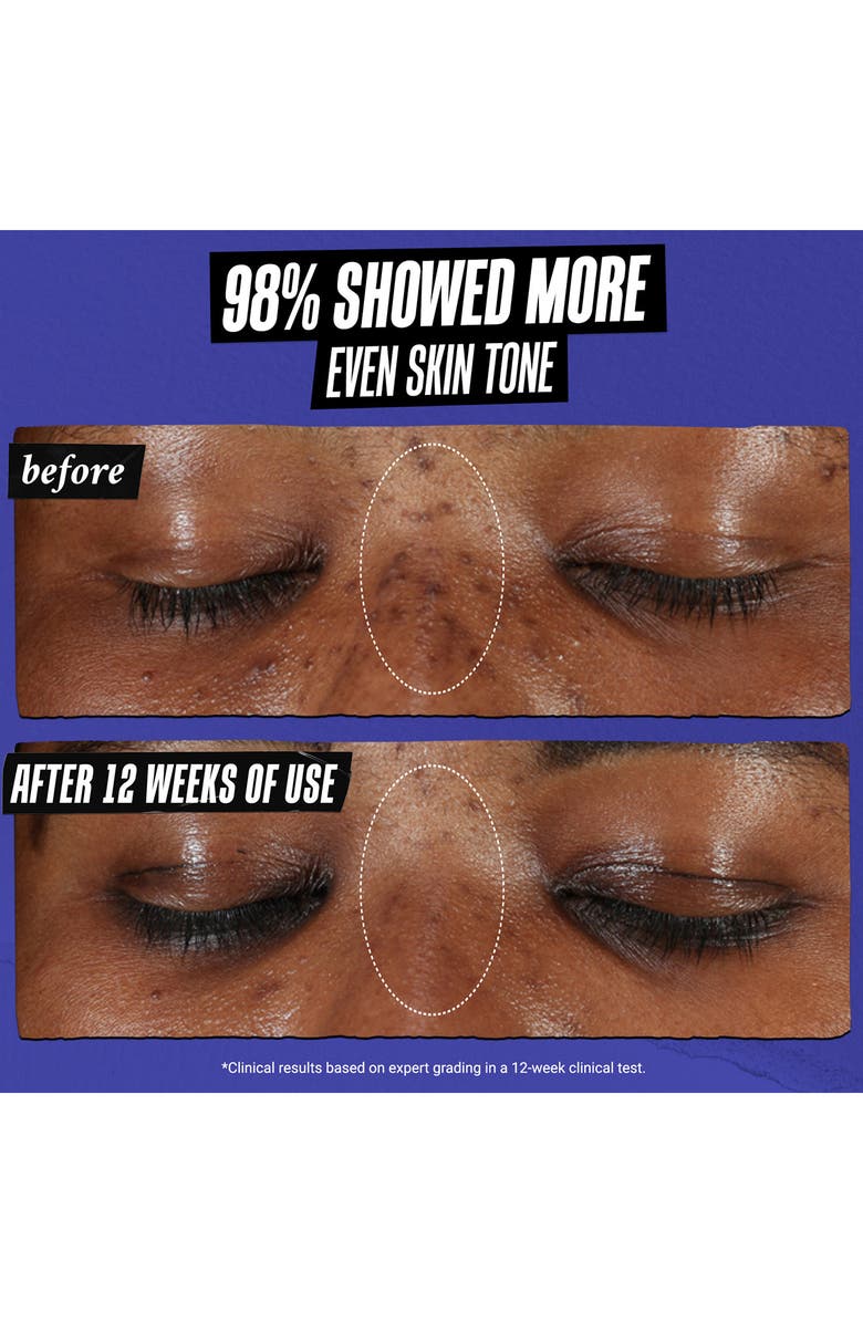 Kiehl's Since 1851 Clearly Corrective<sup>™</sup> Dark Spot Solution Face Serum, Alternate, color,