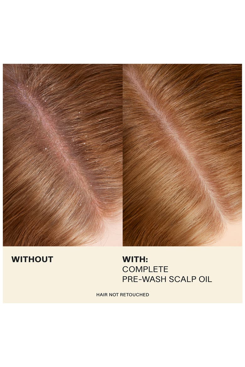Complete Pre-Wash Scalp Oil, Alternate, color, NO COLOR