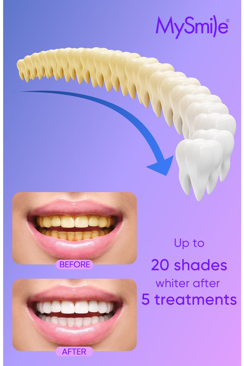 Teeth Whitening Gel Refill Pack with 35% CP, Alternate, color, White
