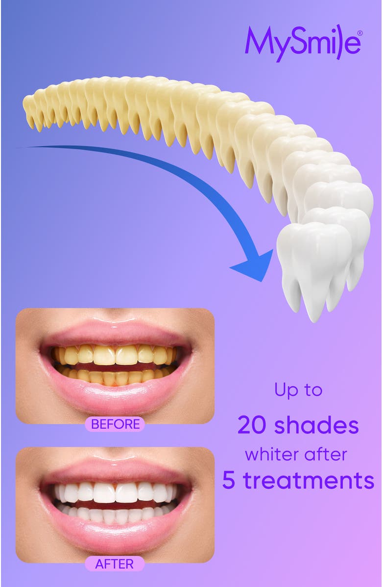MySmile Teeth Whitening Gel Refill Pack with 35% CP, Alternate, color, White
