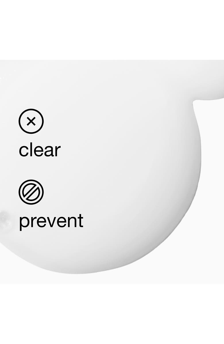 Clinique Acne Solutions Acne + Line Correcting Serum, Alternate, color,