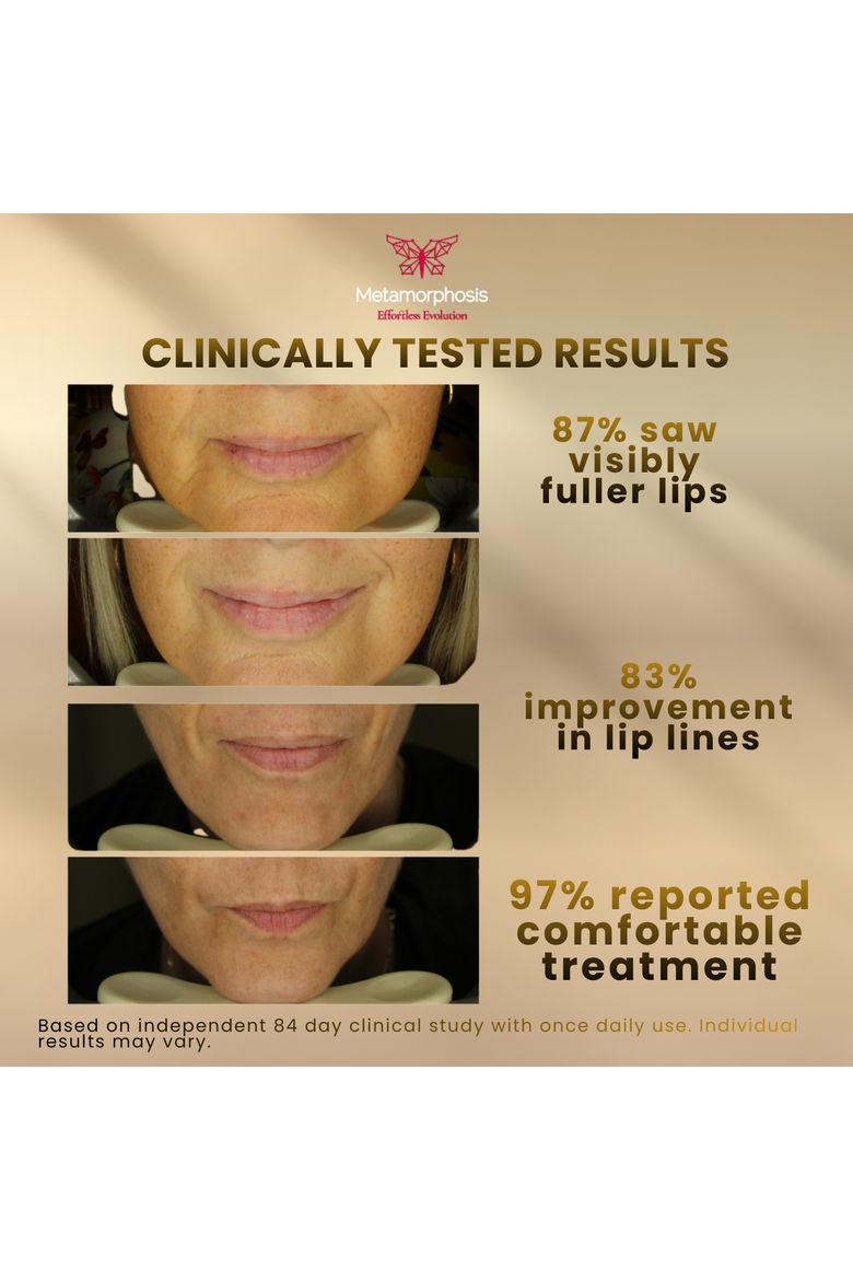 LushLips Transformation Red Light Therapy Lip and Perioral Rejuvenation System, Alternate, color, Pastel Pink