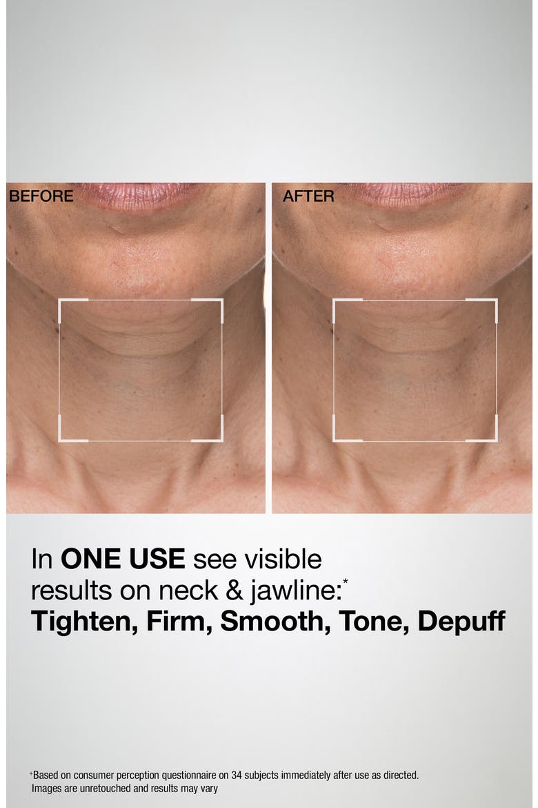TL Advanced™ Sculpting Neck & Jawline Mask, Alternate, color, NO COLOR