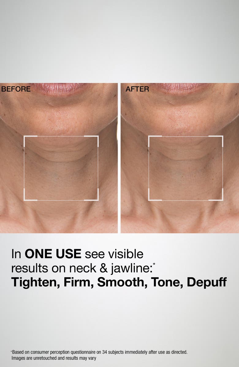 StriVectin<sup>®</sup> TL Advanced<sup>™</sup> Sculpting Neck & Jawline Mask, Alternate, color,