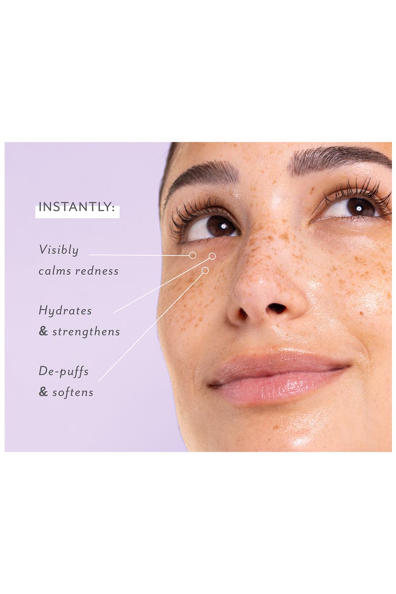 5-Pack Skin Remedy Soothing Eye Gels, Alternate, color, NO COLOR