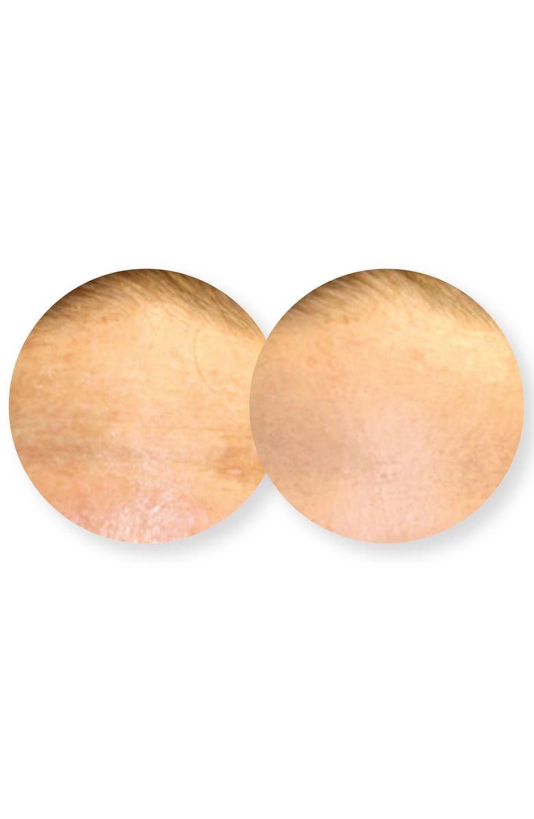 Dermovia Lace Your Face Brightening Bearberry Compression Facial Mask, Alternate, color,