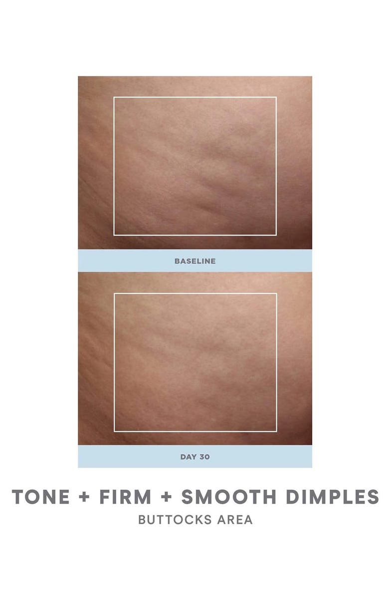 NuFACE<sup>®</sup> Refreshed NuBODY Skin Toning Device & Hydrating Aqua Gel Set, Alternate, color, 