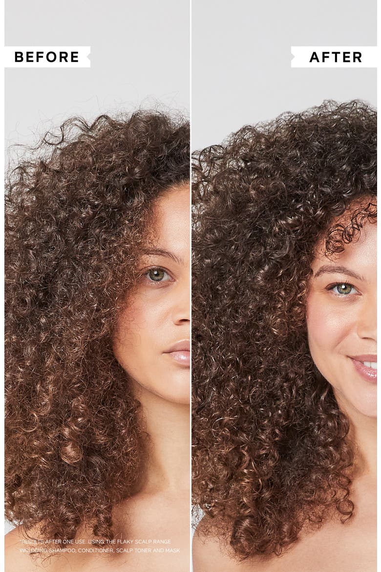 Flaky Scalp Cleansing Shampoo, Alternate, color, NO COLOR