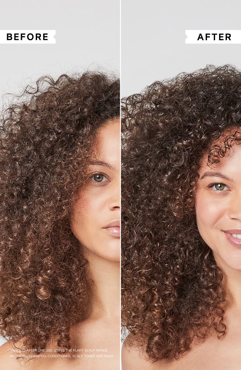 Philip Kingsley Flaky Scalp Cleansing Shampoo, Alternate, color,