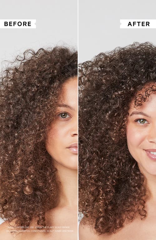 Philip Kingsley Flaky Scalp Cleansing Shampoo In Transparent