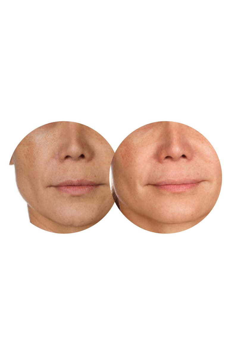 Dermovia Lace Your Face Hydrating Rose Water Compression Facial Mask, Alternate, color, 