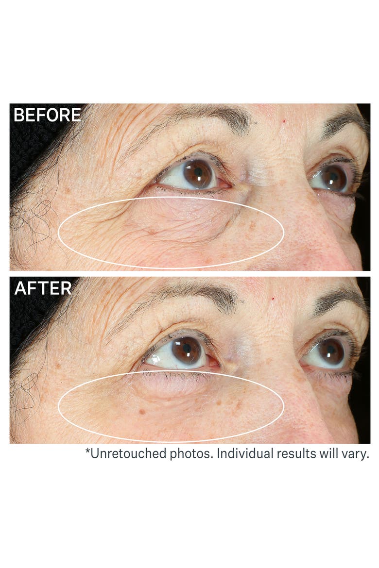 Hyperlift Eye™ Instant Eye Fix Tightening Treatment, Alternate, color, NO COLOR