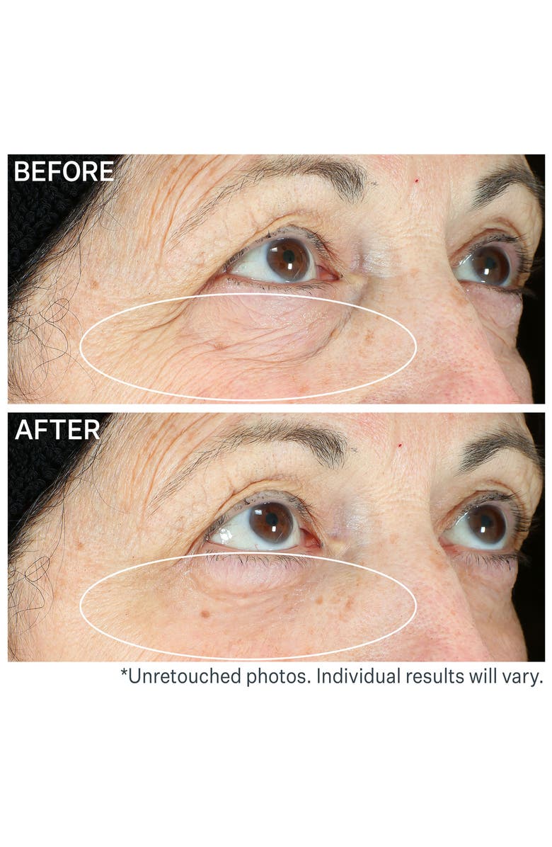 StriVectin<sup>®</sup> Hyperlift Eye<sup>™</sup> Instant Eye Fix Tightening Treatment, Alternate, color,