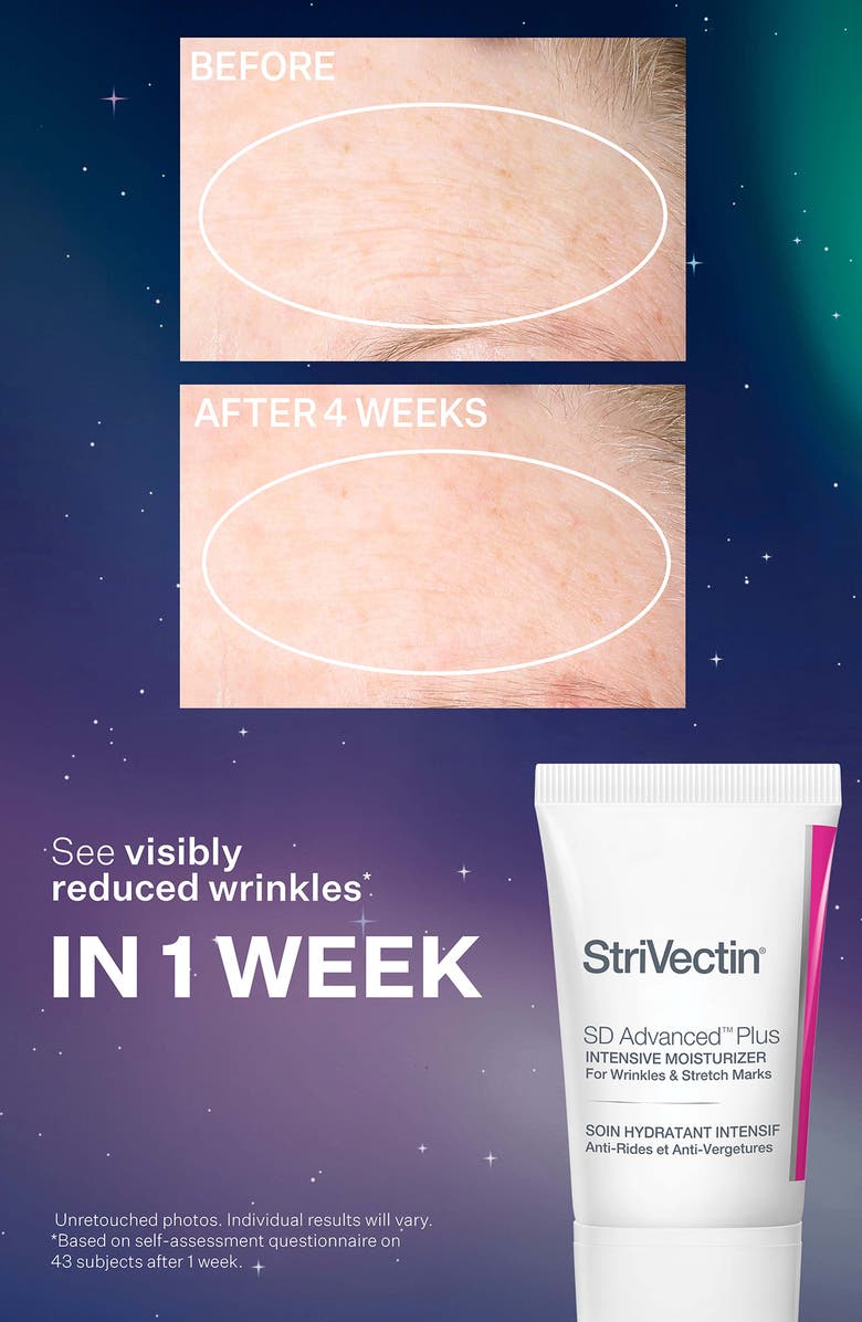 StriVectin<sup>®</sup> Smooth & Plump Holiday Skin Care Set (Limited Edition) $193 Value, Alternate, color, 