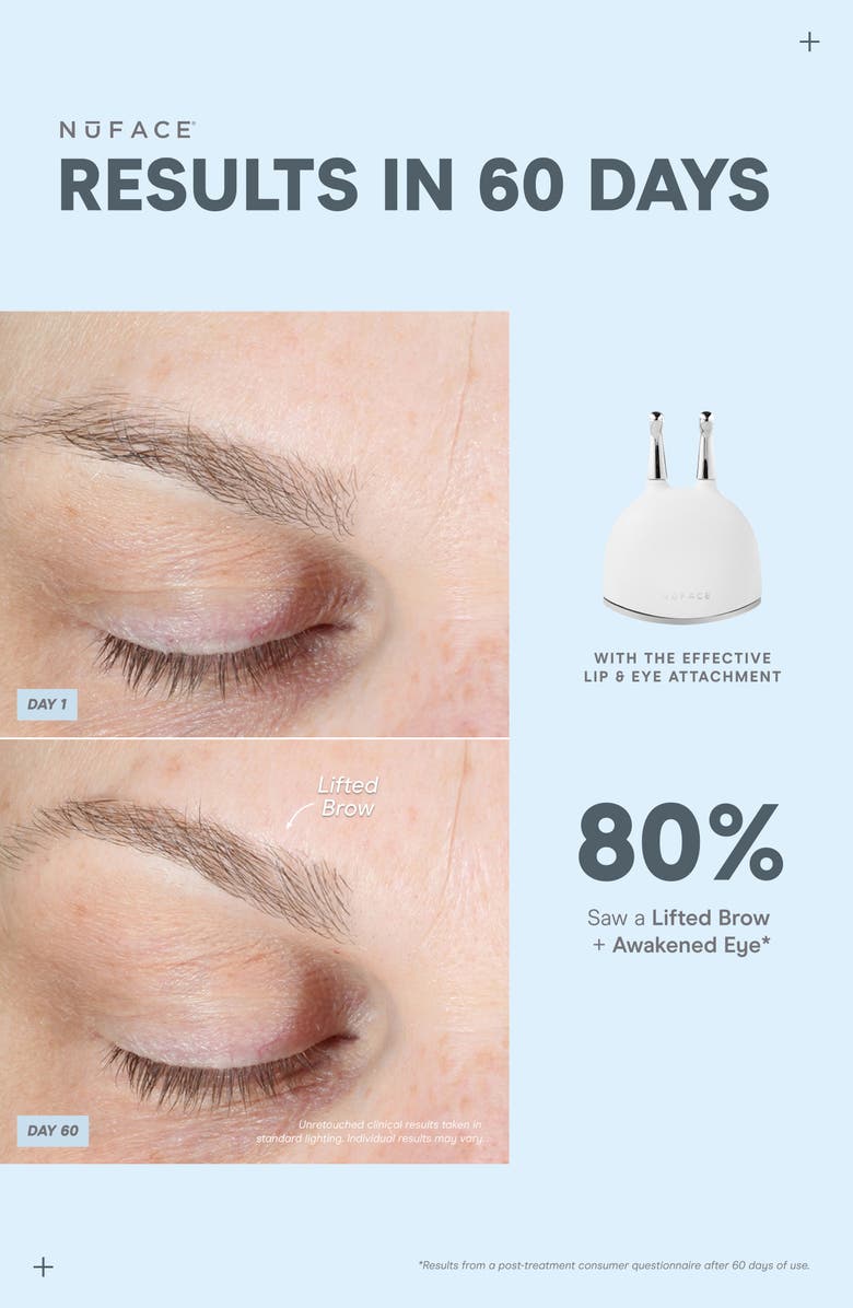 NuFACE<sup>®</sup> TRINITY+ Complete Set $785 Value, Alternate, color,