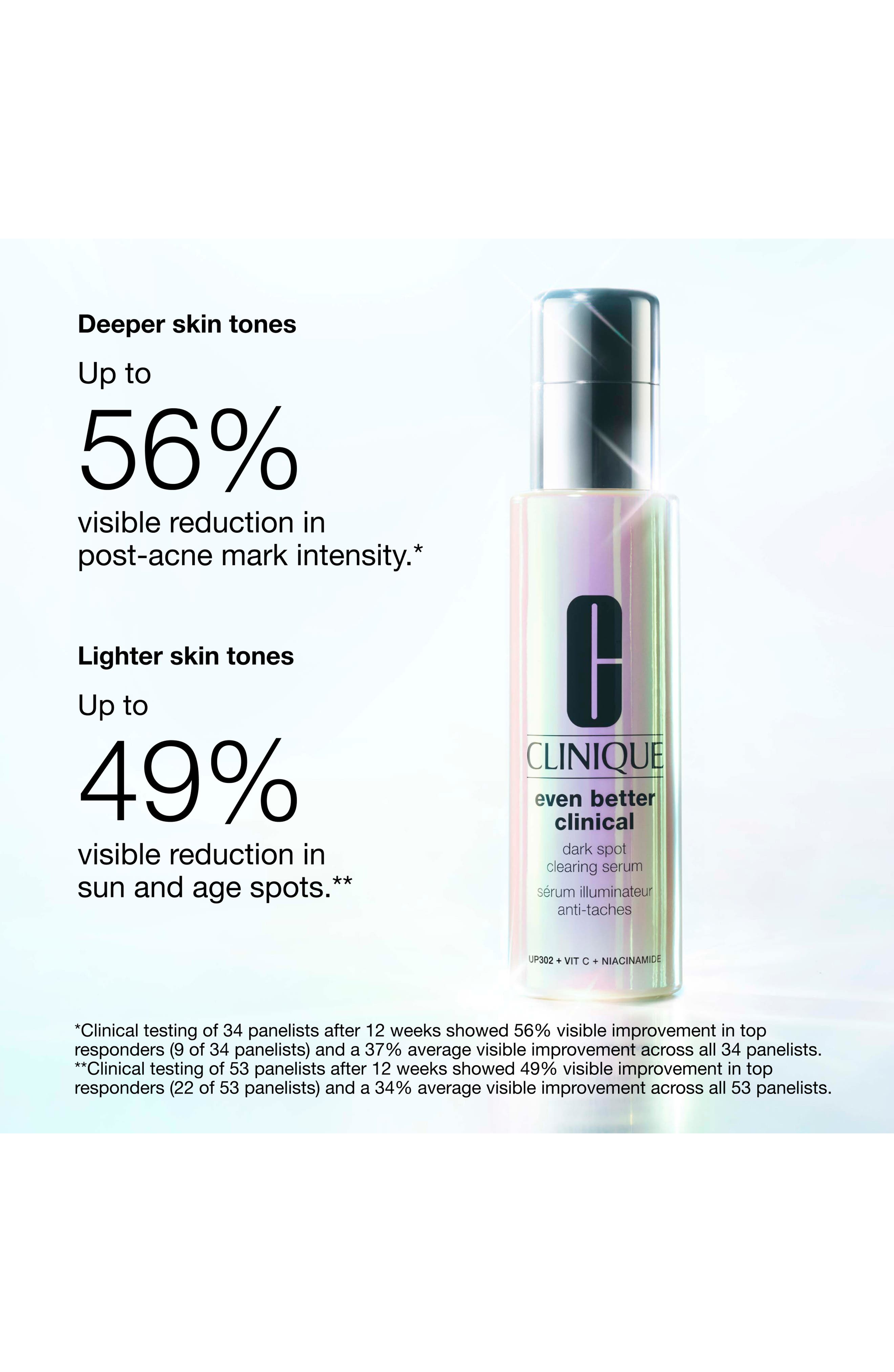 Even Better Clinical™ Dark Spot Clearing Serum (Women) | Nordstrom