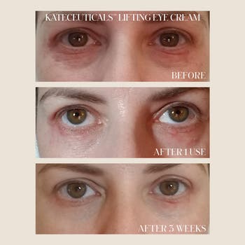 Kate Somerville Lifting deals Eye Cream