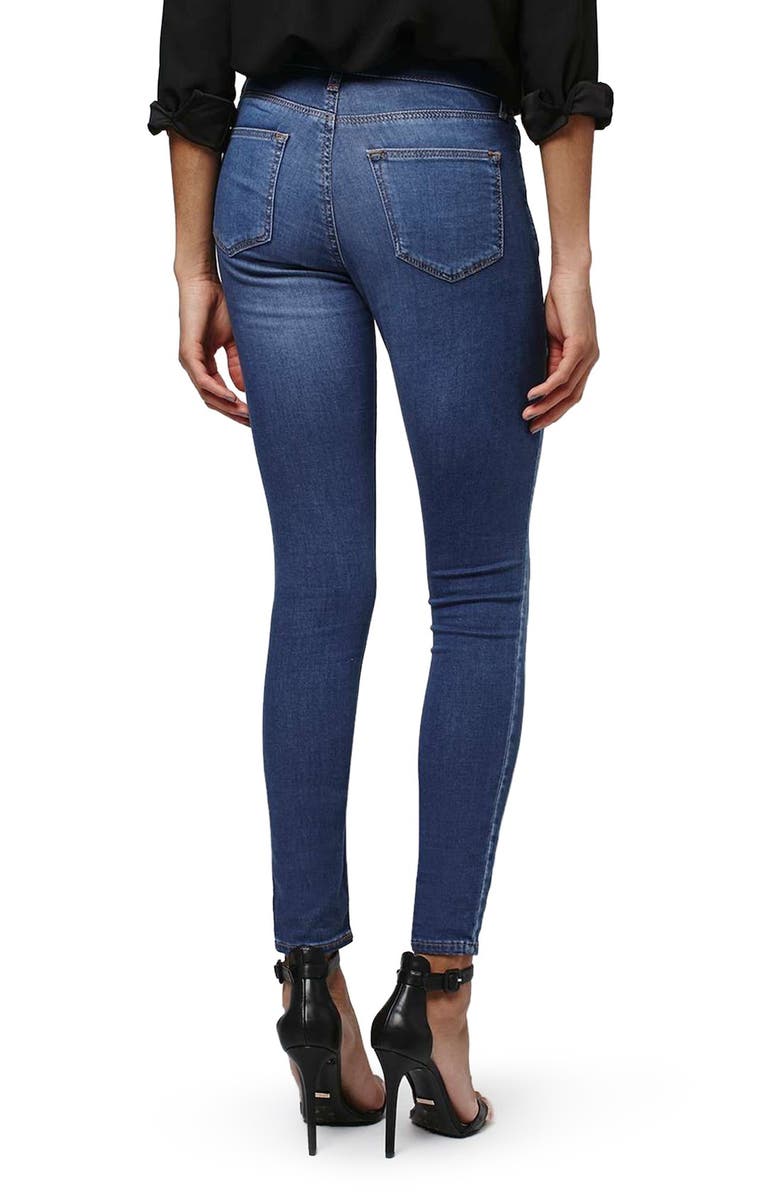 Topshop 'Leigh' Ankle Skinny Jeans, Alternate, color,