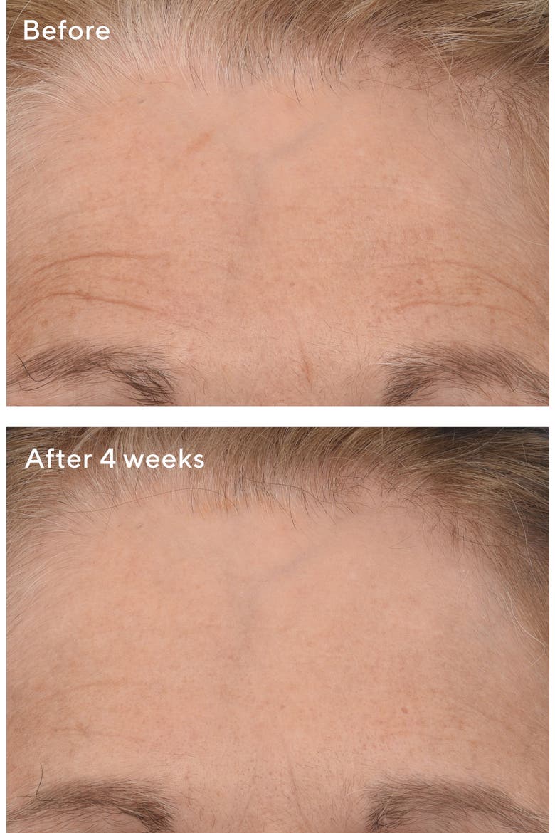 Resurgence™ Retinal ReSculpt™ Overnight Treatment, Alternate, color, NO COLOR