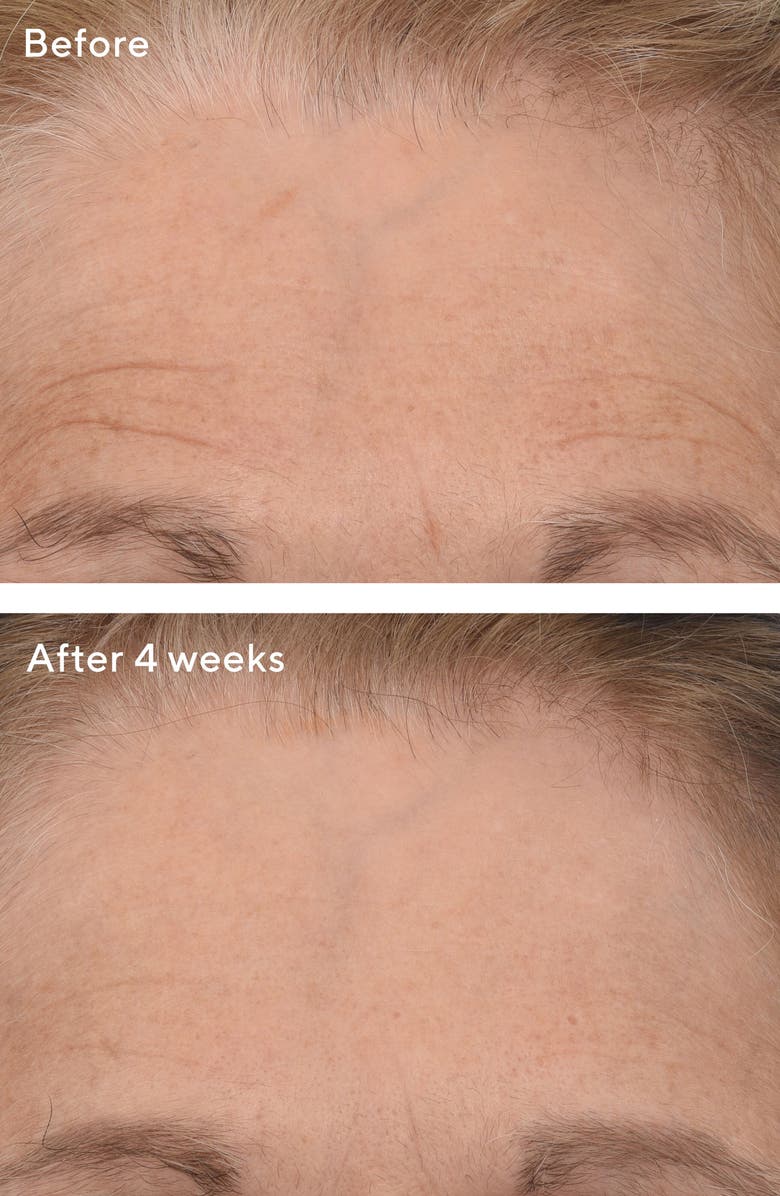 Murad<sup>®</sup> Resurgence<sup>™</sup> Retinal ReSculpt<sup>™</sup> Overnight Treatment, Alternate, color, 