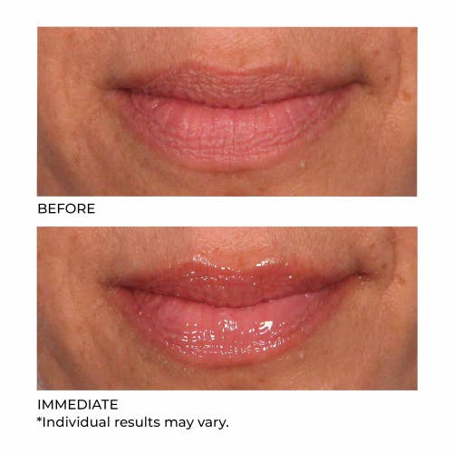 Dr. Nassif Skincare Hydro-screen For Lips In Vanilla