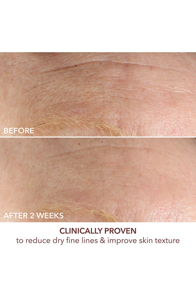 Dr. Dennis Gross Skincare Advanced Retinol + Ferulic Intense Wrinkle Cream, Alternate, color, 